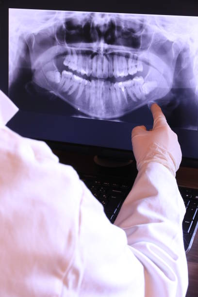 Best Emergency Dental Care for Abscessed Tooth in Marbury, AL