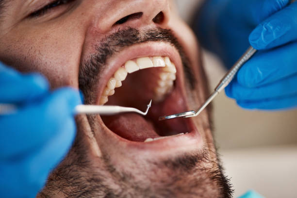 Best Emergency Dental Extractions in Marbury, AL